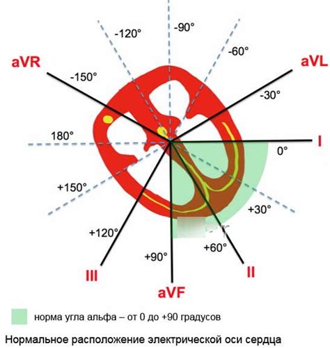 Ось сердца горизонтальная у ребенка