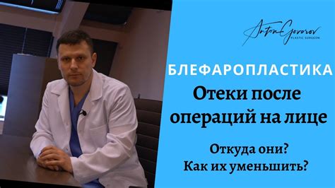 Отеки после операций или лечения