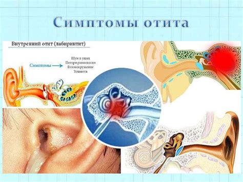 Отит взрослых: особенности и лечение