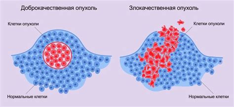 Откройте главные симптомы новообразования