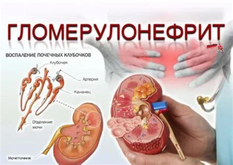 Отличия нефрологии от диализа