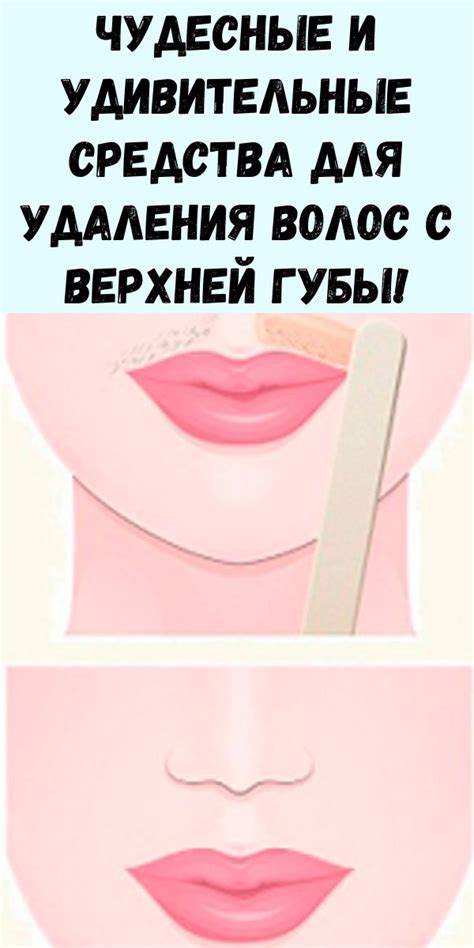 Отрицательные предсказания: значение сновидения об удалении волос у верхней губы