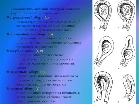 Отслойка плодного пузыря: страшное осложнение