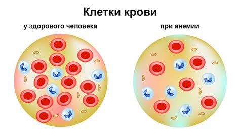 Отсутствие выработки эритроцитов в крови: причины и последствия