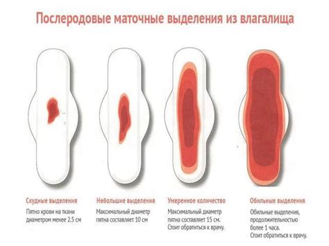 Отсутствие месячных при использовании Норколута: миф или реальность?