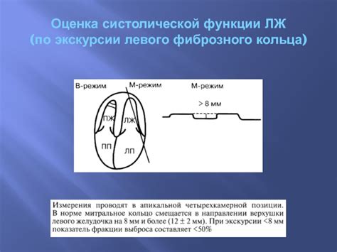 Оценка глобальной систолической функции