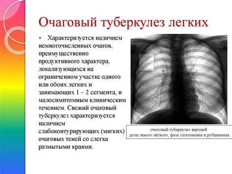 Очаговый туберкулез - опасное заболевание