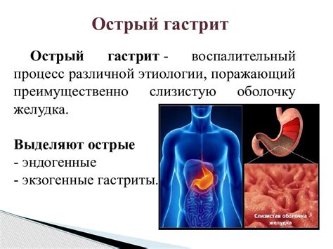 Ощущение окоченелости и онемения