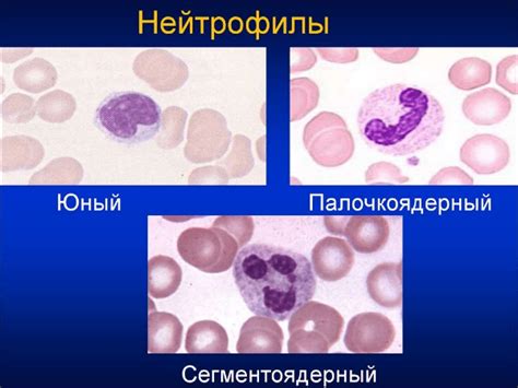 Палочкоядерные нейтрофилы у женщин