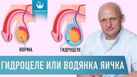 Пальпация яичек у мужчин: необходимость и основные методы