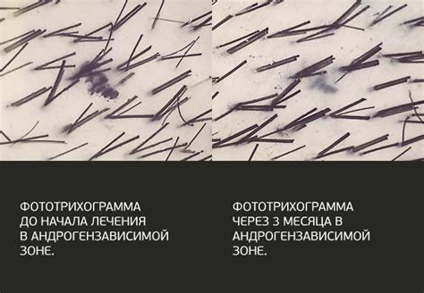 Парабены: вредные свойства и последствия для волос и кожи головы