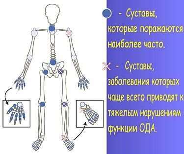 Паравертебральные мягкие ткани: важный компонент организма