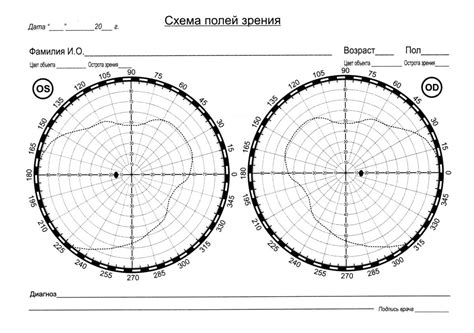 Параметр поля зрения