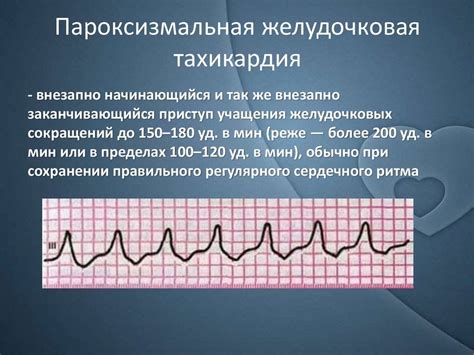 Пароксизм желудочковой тахикардии: симптомы и причины