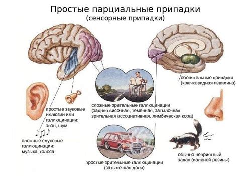 Парциальные припадки: основные причины, симптомы и методы лечения