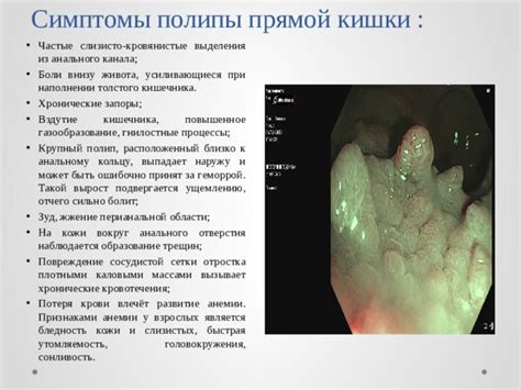 Патологии кишечника и анального отверстия