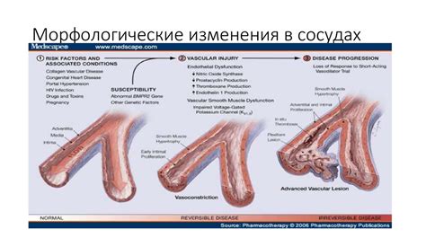 Патологические изменения в сосудах