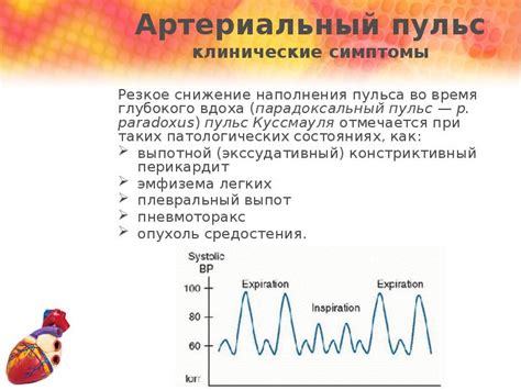 Патологические причины увеличения наполнения пульса