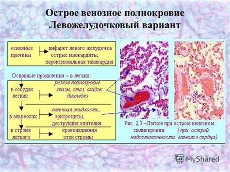 Патологические проявления эпиактивности