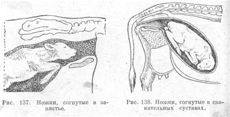 Патологические роды: причины