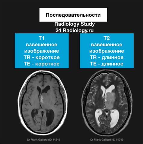 Патологический сигнал при МРТ: