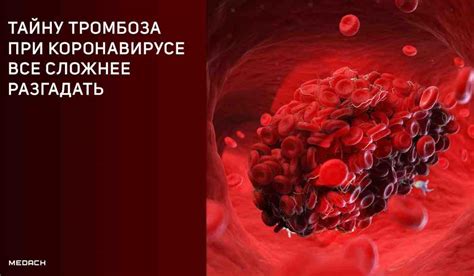 Патологическое явление: суть, причины и последствия