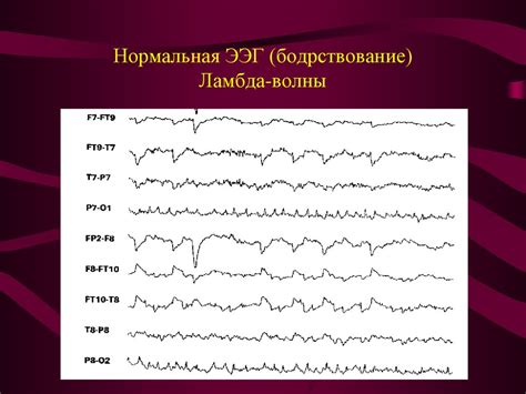 Паттерны ЭЭГ: понятие, типы и применение