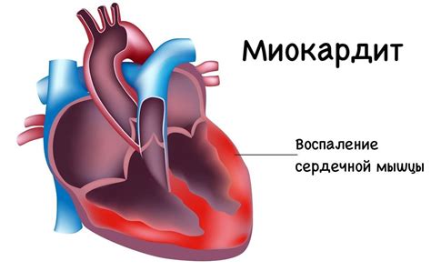 Пациенты без патологии сердца