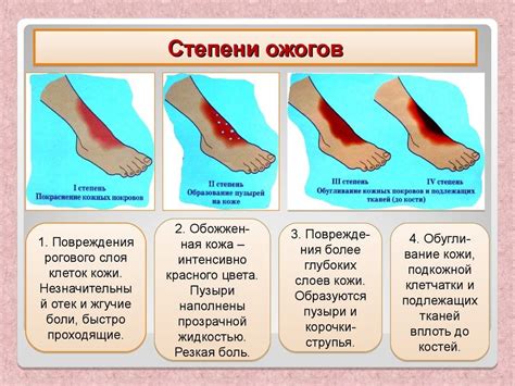 Первая помощь при ожоге: что делать и чего не делать