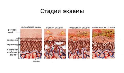 Первые признаки волдырей: как распознать проблему