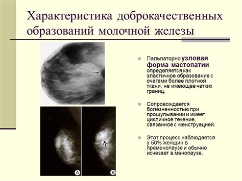 Первые признаки новообразования в молочной железе в сфере сновидений