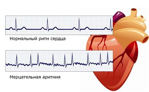 Перенапряжение сосудов: что это значит и как лечить