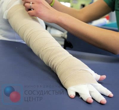 Перетягивание bandage: что это?