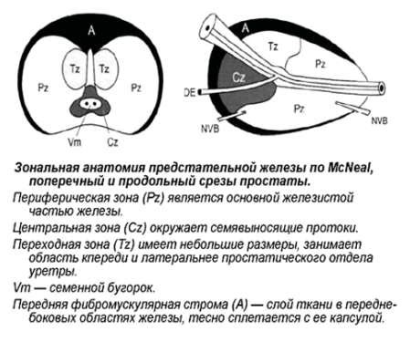 Периневральный рост опухоли предстательной железы