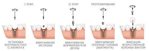 Период регенерации и ожидания формирования новой десны