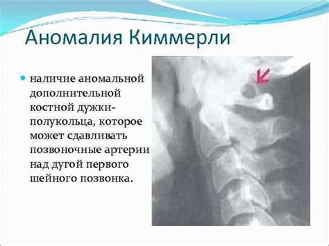 Перспективы решения проблемы полной аномалии Киммерли