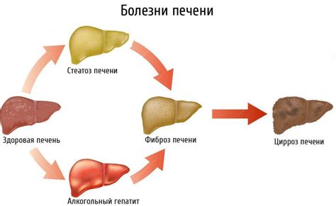 Печень: главный фильтр организма