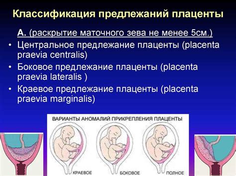 Плацента по левой боковой стенке: