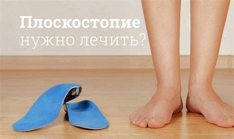 Плоскостопие и цианоз