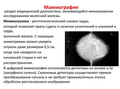 Плотность молочных желез типа С: объяснение и последствия