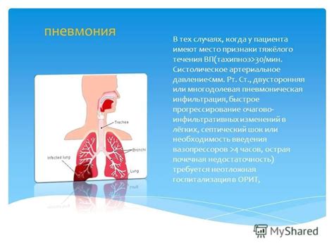 Пневмония: когда необходима госпитализация?