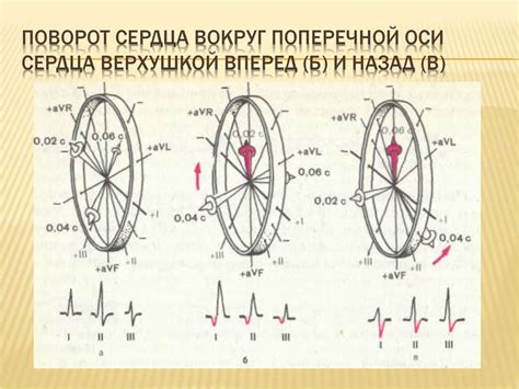 Поворот продольной оси сердца