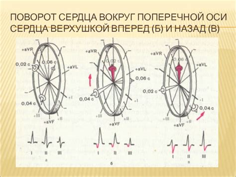 Поворот сердца верхушкой назад