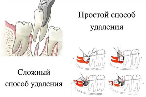 Повреждение десны