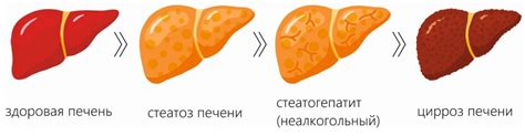 Повреждение печени