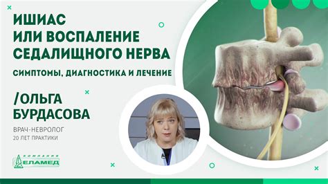 Повреждение седалищного нерва