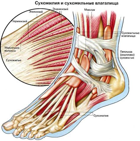 Повреждение сухожилия