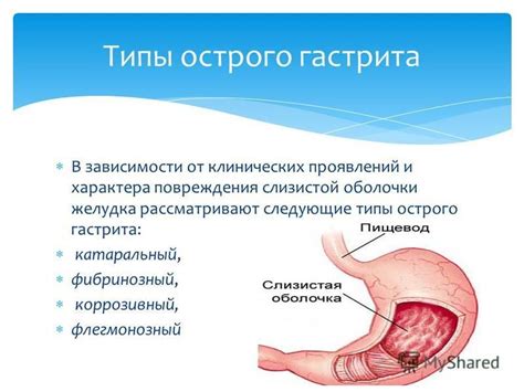 Повреждения слизистой оболочки желудка