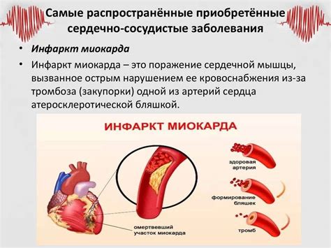 Повышение вероятности сердечно-сосудистых заболеваний