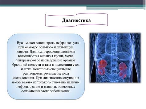 Повышенная подвижность почек: определение и причины